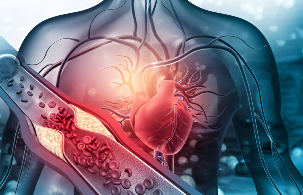 Hipertensiune arteriala: Cauze, Simptome, Tratament